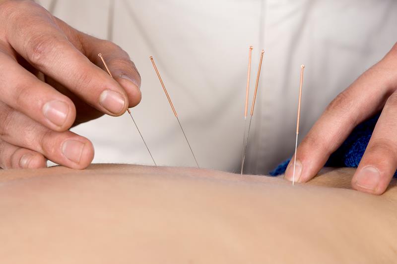 Acupuncture  Herndon, VA