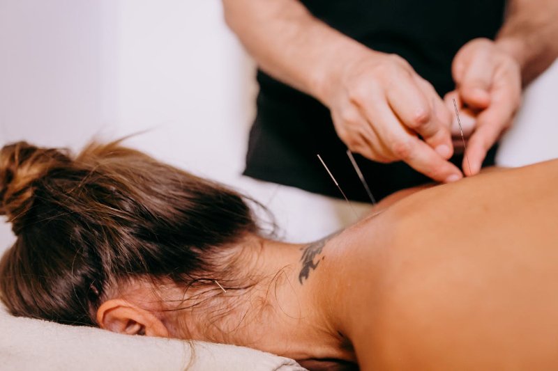 Motion Acupuncture  Herndon, VA