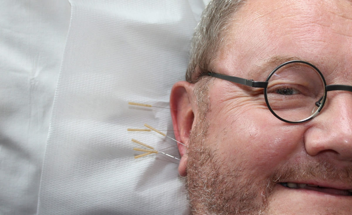 Auricular Therapy (BFA)  Herndon, VA